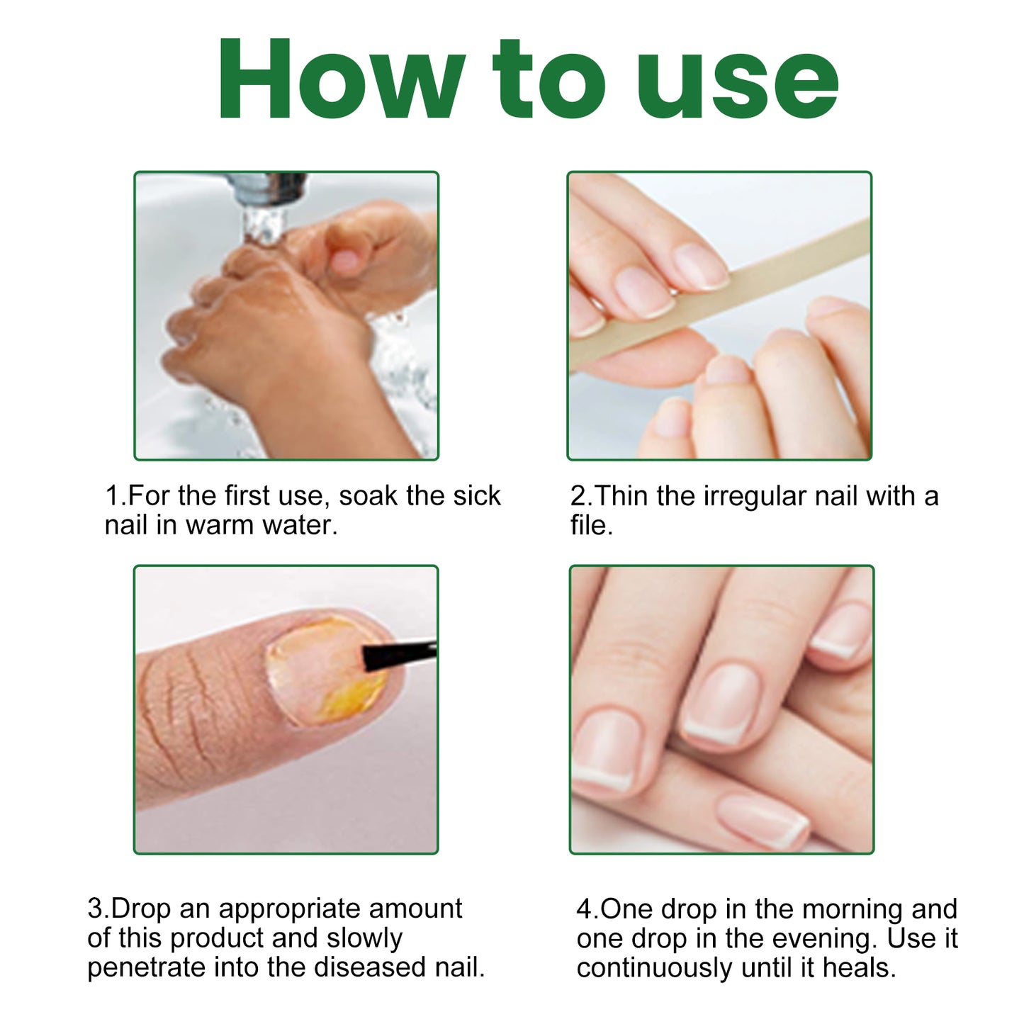 EELHOE Gray Nail Repair Remove Gray Nail Nourishing Lotion, Brightening Soft Nails Moisturizing Nail Care Solution For Hands, Feet And Nails