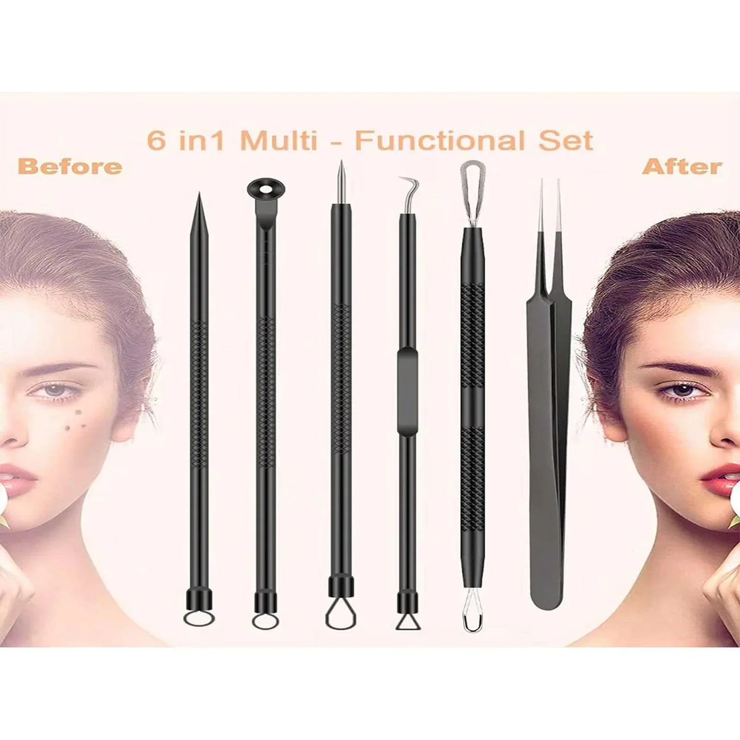 Acne Removal Needle Set for Skincare