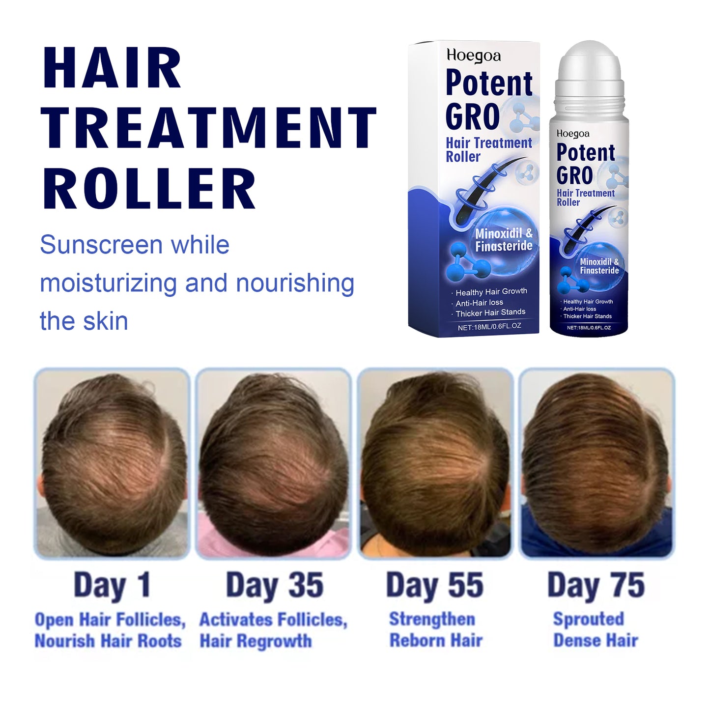 HOEGOA Hair Treatment Roller, Repair Strong And Firm Hair Moistening Hair Roots Thick, Smooth And Dense Hair Care Ball