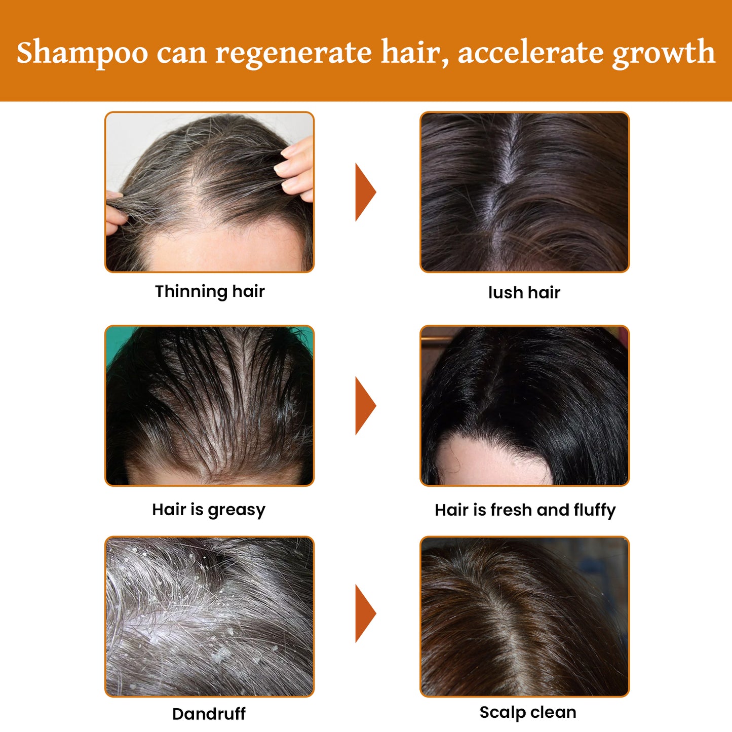 Rice Dense Hair Shampoo Deep Clean Thick Hair Moisturizing Hair Root Solid Hair Care Shampoo