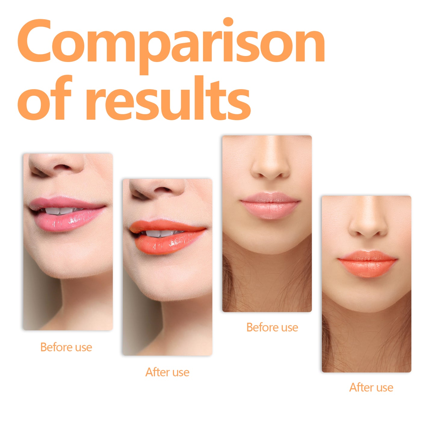 Changing Lip Oil, Mildly Removes The Lips Cutin Plentiful Full Fine Light Zerun Lip Oil