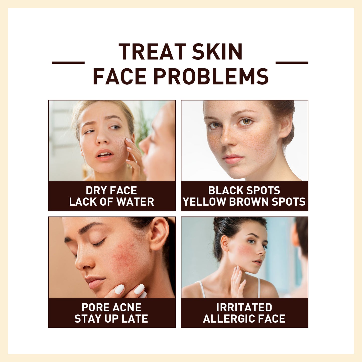 Rice Anti Wrinkle Essence, Repairs Skin Moisturizes Firms Whitens Essence