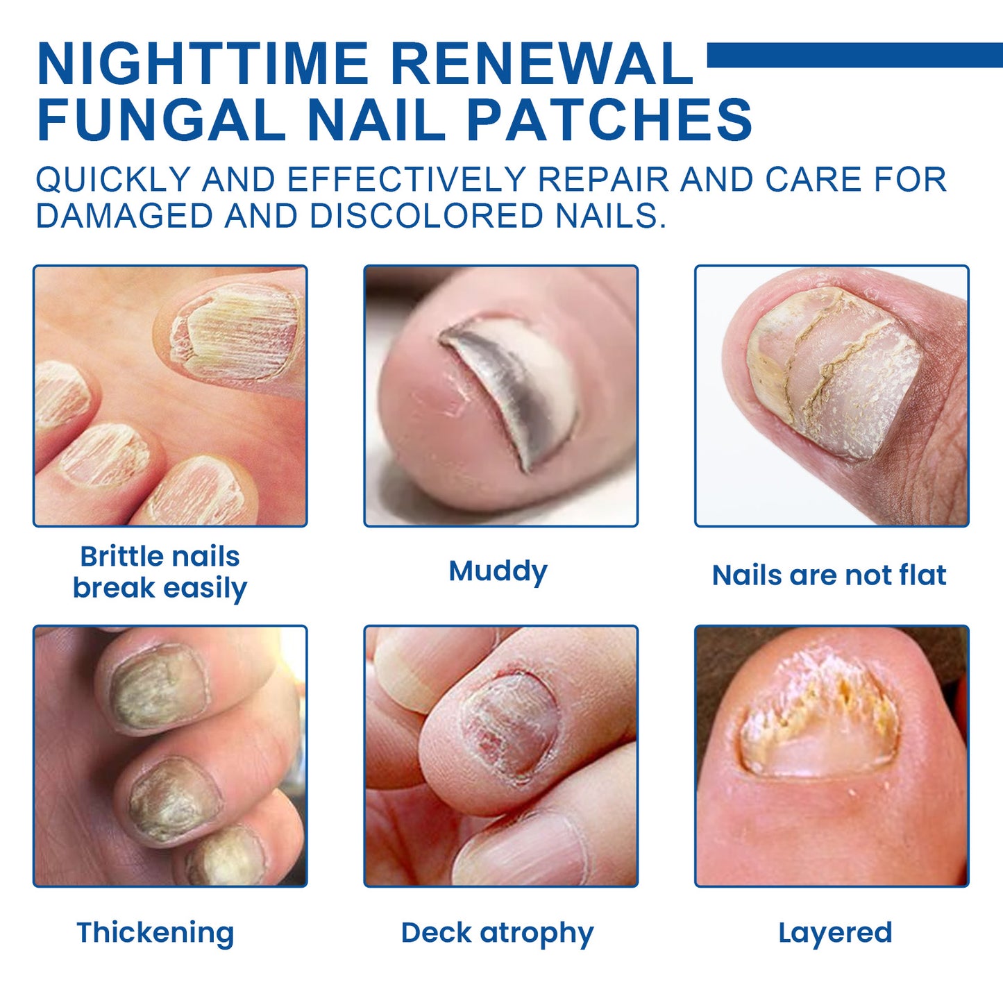 Nighttime Renewal Fungal Nail Patches, Repair And Thickening Gray Nail Insert Soft Nail Care Patch