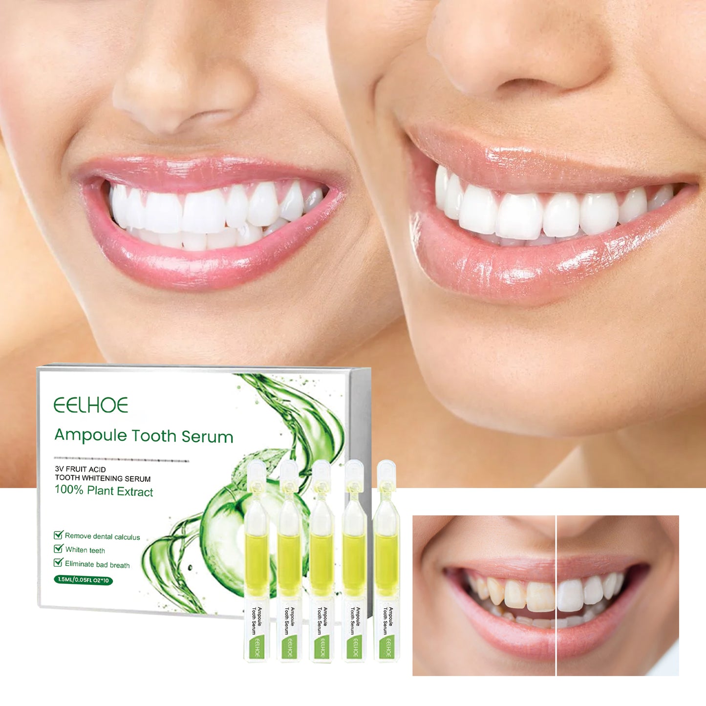 Teeth Whitening Serum To Remove Stains, Bad Breath, Whitening Teeth And Whitening Teeth