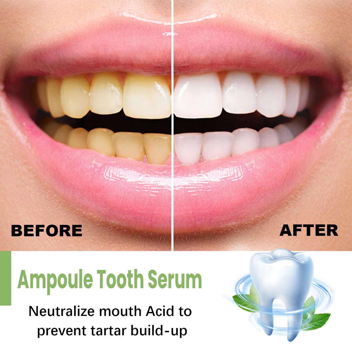 Teeth Whitening Serum To Remove Stains, Bad Breath, Whitening Teeth And Whitening Teeth