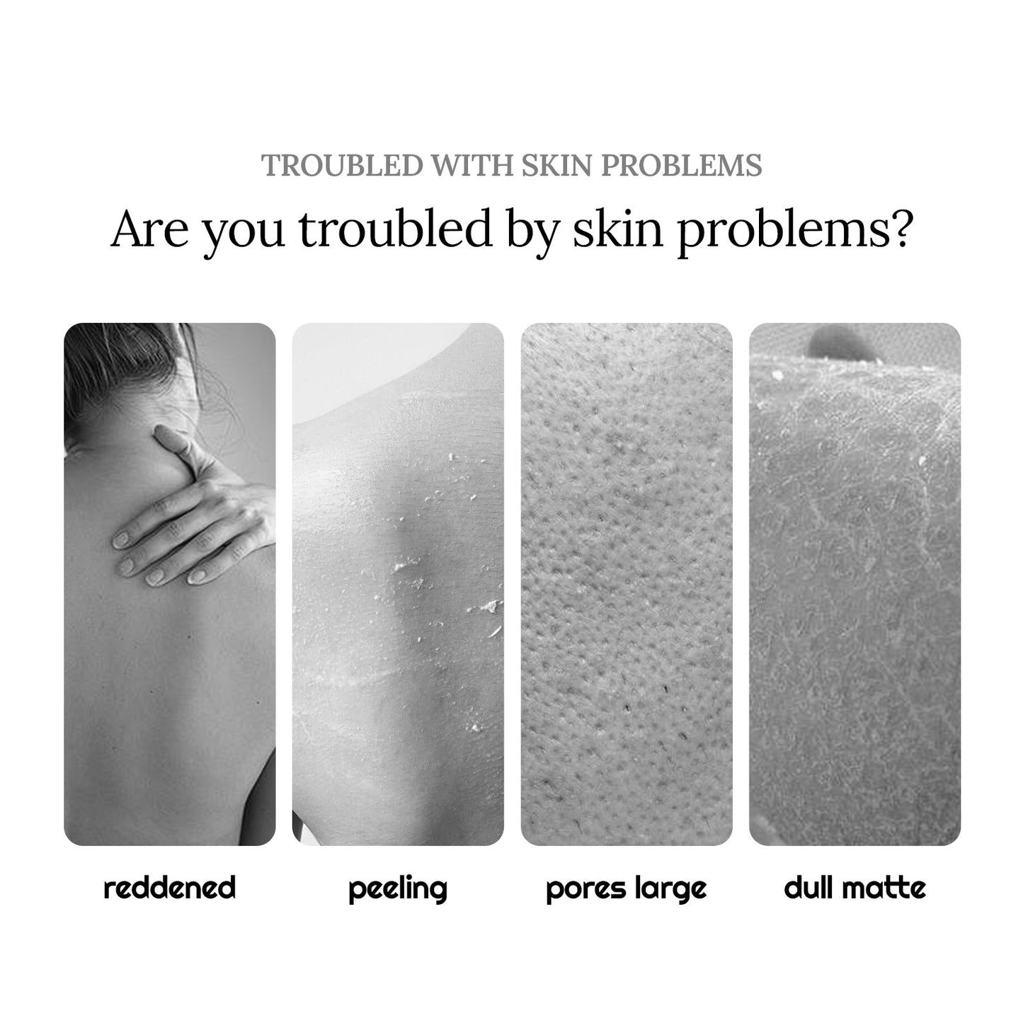 Propolis Shower Lotion, Body Skin Cleansing And Moisturizing Dull Exfoliating Body Wash